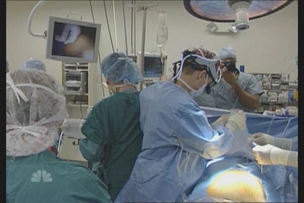 Still capture from the Dateline: Miracle Workers video report: doctors and nurses prepare for surgery on a unborn baby still inside the womb